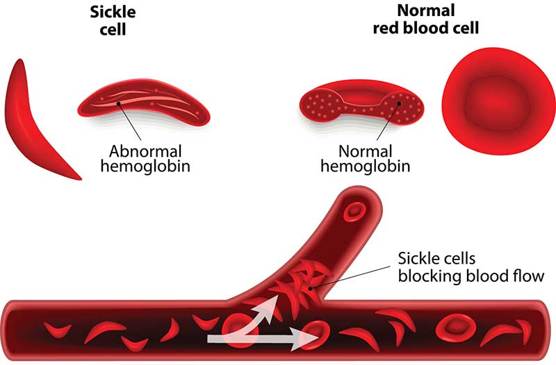 blood_cells